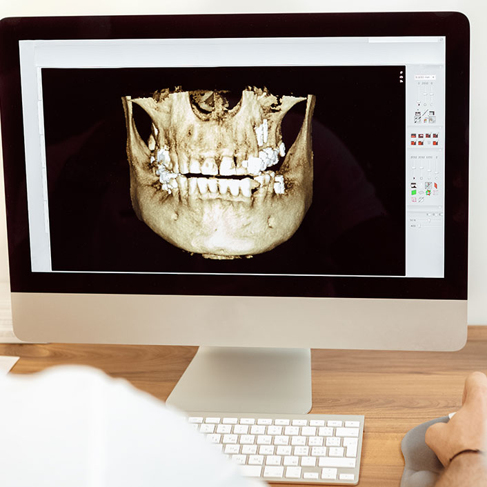 3D Cone Beam CT scan machine in a dental office setting.