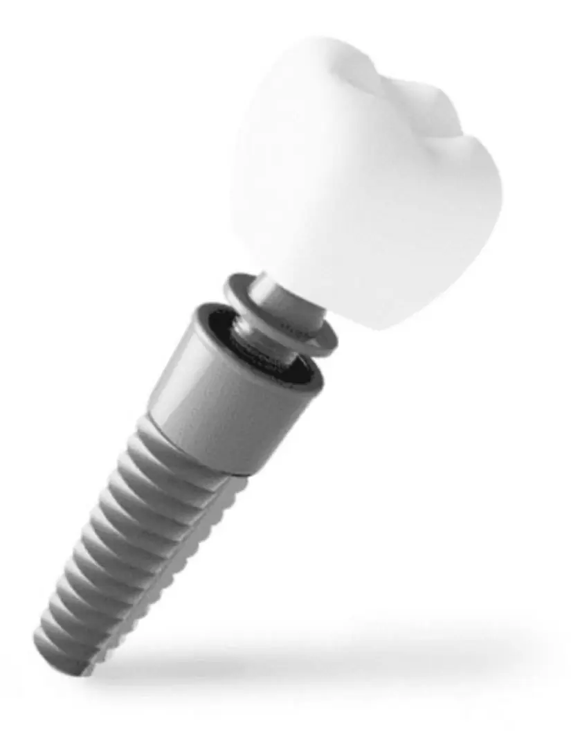 What is an implant restoration?